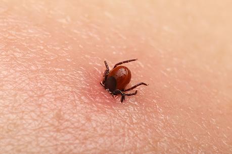 Lyme Disease Treatment