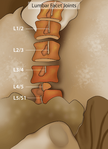 L5 S1 Or Lumbosacral Joint: What Is It And What Should You Be Wary Of?