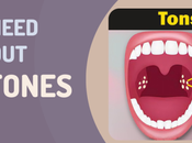 Things Need Know About Tonsil Stones
