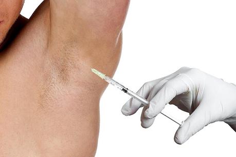 Hyperhidrosis Treatment