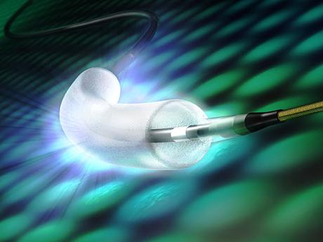 Drug Eluting Balloon Market