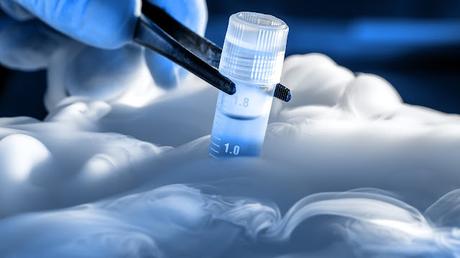 Global Cell Cryopreservation Market is Estimated To Witness High Growth Owing To Technological Advancements