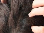 Global Scalp Care Market Estimated Witness High Growth Owing Rising Demand Natural Organic Products