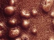 Global Smallpox Treatment Market Estimated Witness High Growth Owing Innovative Therapies