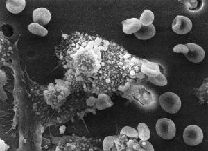 macrophages killing cancer cell