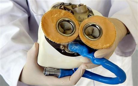 French heart transplant specialist Alain Carpentier presents a prototype of the world's first fully implantable artificial heart. 