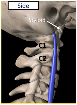 What Is Intracranial Hypertension And How Is It Connected To The Neck?