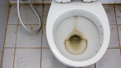 5 Tips to Prevent Toilet Rust
