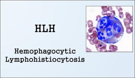 Ayurvedic Treatment for Hemophagocytic Lymphohistiocytosis (HLH) In Adults