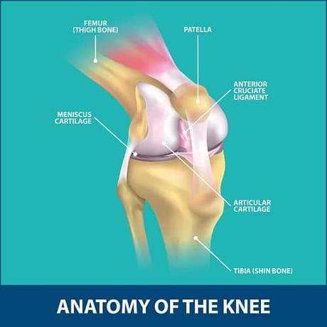 Kneecap Fractures (Patella Fractures) 10 Kneecap Fractures