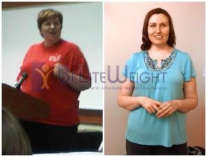 Best Weight Loss Surgery in USA, California, CA