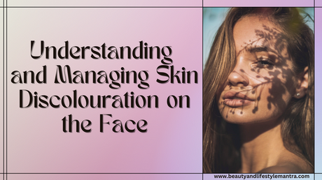 Understanding and Managing Skin Discolouration on the Face Skin Discolouration on the Face