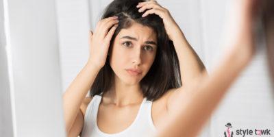 Home Remedies for Dandruff