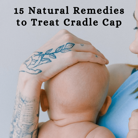 Cradle cap is common in infants, and nothing to worry about! Here are 15 easy and effective natural remedies to treat Cradle Cap in babies.
