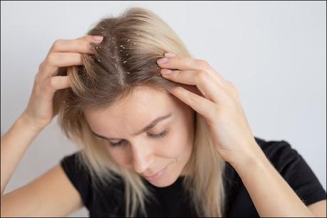 What Is Redensyl? – How Does It Help In Hair Growth And Its Ayurveda Alternatives?