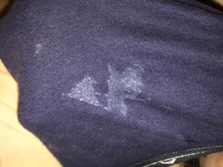 Does Semen Stain On Clothes?  