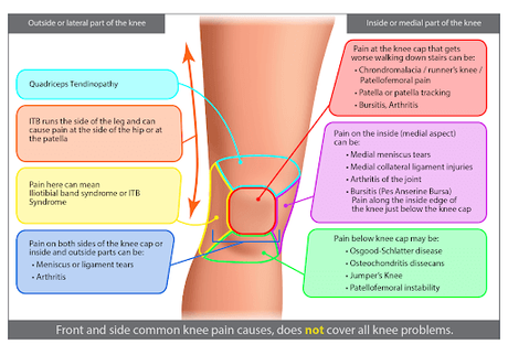 Knee Pain Location Chart: Know What The Pain In Your Knee Means