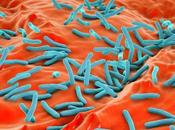 Leaks Accidents Rising Fears Grow That Dangerous Viruses Bacteria Could Escape