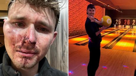 Gay man ‘beaten, spit on and bitten during homophobic attack’