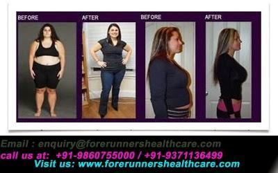 Is Weight loss Surgery benefits India an advantage? Call Us: +234-17101094