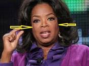 What’s with Those Strange Lines Oprah’s Face?