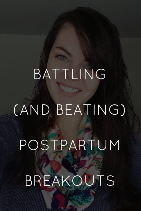 Battling (And Beating) Postpartum Breakouts