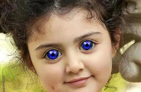 God Is Wonderful, See 25 Photos Of Kids That Where Born With Strange Eyes (Opinion)