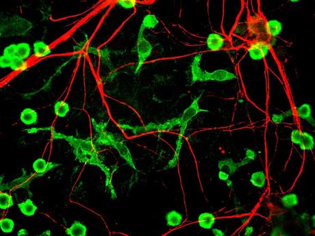 Harnessing the brain’s immune cells to stave off Alzheimer’s and other neurodegenerative diseases