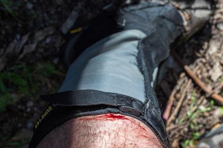bleeding leg whilst hiking