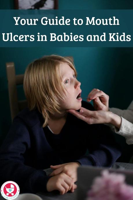 Here's everything you need to know about mouth ulcers in babies and kids. Find out how they look, what causes them and how they can be treated.