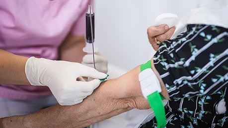 Alzheimer’s Blood Test in Primary Care Could Slash Diagnostic Times