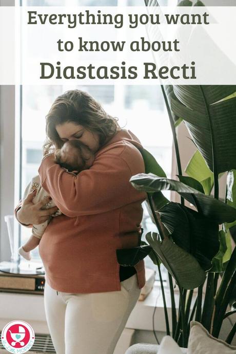 Diastasis Recti is a common condition in postpartum women - here's what you need to know about what it looks like and how to tackle it.