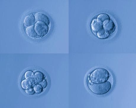 Most human embryos die naturally after conception – restrictive abortion laws do not account for this embryo loss