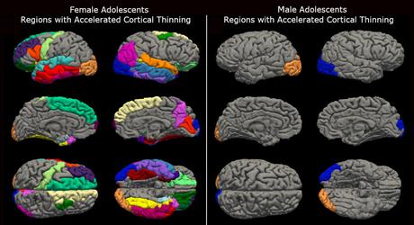 New research suggests teenage brains ‘aged’ during Covid lockdowns