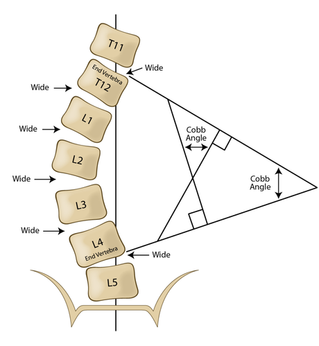 Understanding the Normal Curvature of the Spine