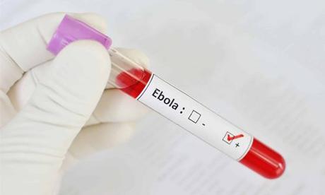 Ebola Virus Disease: Everything You Need to Know