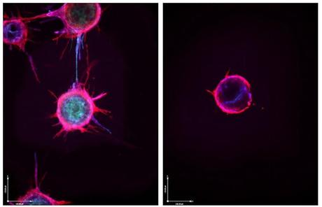 MicroRNA is the Nobel-winning master regulator of the genome – researchers are learning to treat disease by harnessing how it controls genes