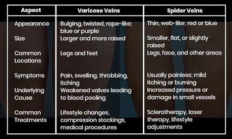 How to Get Rid of Varicose Veins