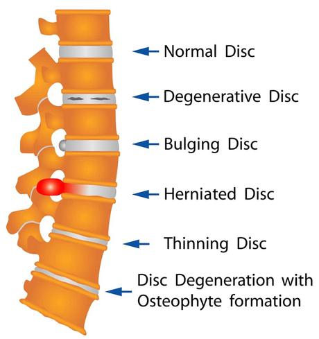 All You Need to Know about the L4 Vertebra