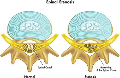 All You Need to Know about the L4 Vertebra