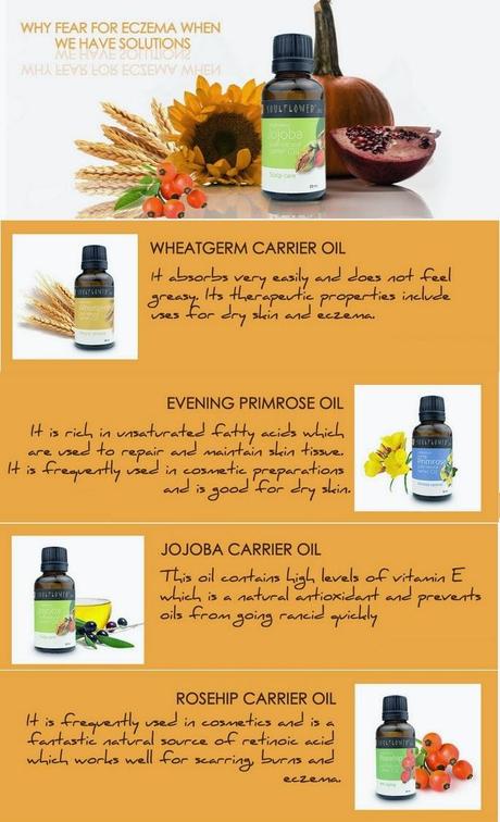Treat Eczema With These Essential Oils!