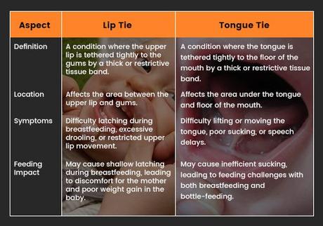 What Causes Lip Ties in Babies and How to Treat Them?