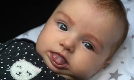 What Causes Lip Ties in Babies and How to Treat Them?