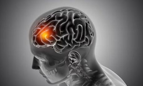 Brain Herniation: Types, Symptoms, and Treatment