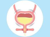 Natural Treatment Overactive Bladder