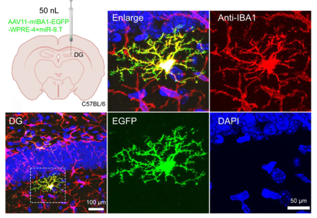 The Guardian of the Brain – Microglia.