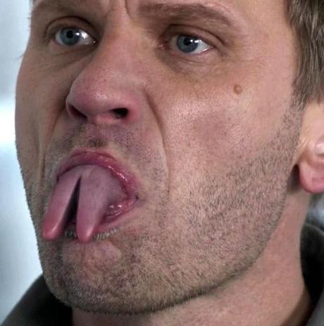 Ten Outrageous Cosmetic Surgeries You Won’t Believe Exist Tongue Splitting