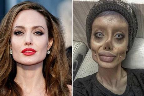Ten Outrageous Cosmetic Surgeries You Won’t Believe Exist Ten Outrageous Cosmetic Surgeries You Won’t Believe Exist