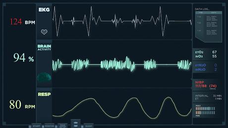 ECG Explained: How This Simple Test Protects Your Heart Health ECG Explained: How This Simple Test Protects Your Heart Health