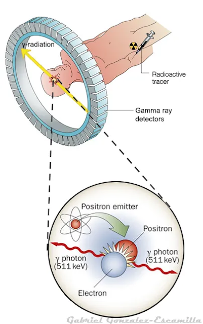 fdg-tracer fdg-tracer